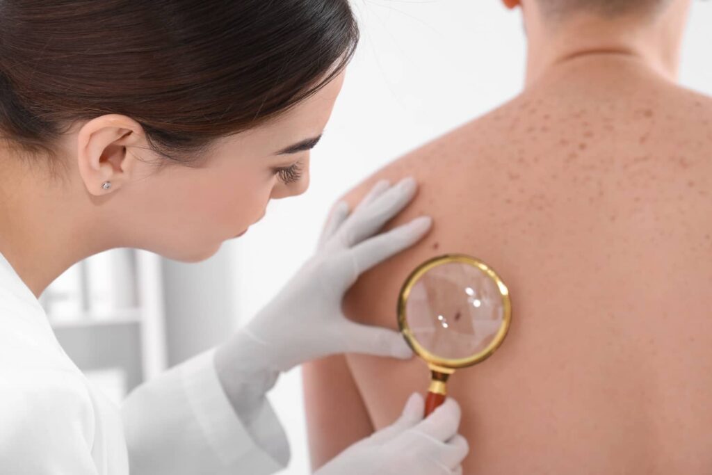 A dermatologist examining a mole on the patient's back.