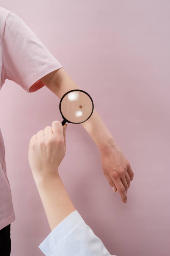 A dermatologist checking a patient's mole on their arm